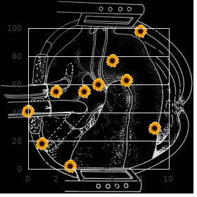 Great vessels transposition