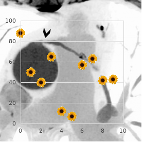 Spinocerebellar ataxia dysmorphism