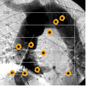 Facies unusual arthrogryposis advanced skeletal malformations