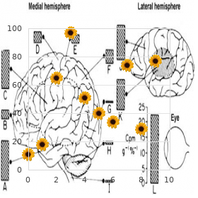 Woolly hair autosomal recessive