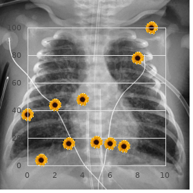 Toluene antenatal infection