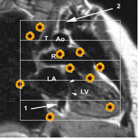 Portal hypertension