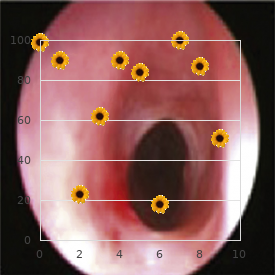 Tinnitus