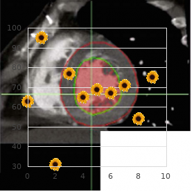 Neuroepithelioma