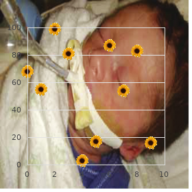 Mesomelic dwarfism Langer type