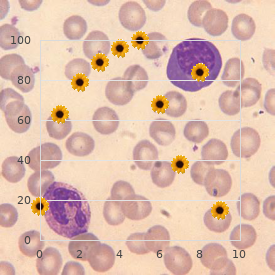 Myoclonus