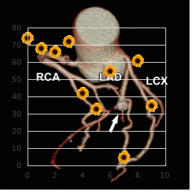 Chromosome 5, uniparental disomy