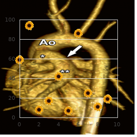 Smet Fabry Fryns syndrome