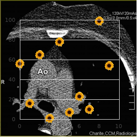 Dermatocardioskeletal syndrome Boronne type