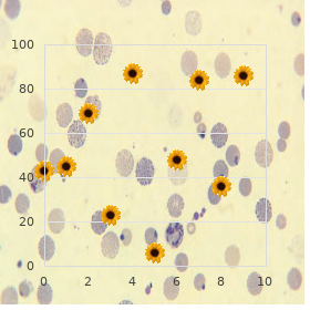 Splenogonadal fusion limb defects micrognatia