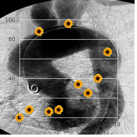 Goldblatt Wallis Zieff syndrome