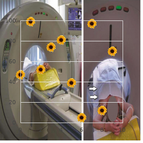 Blood platelet disorders