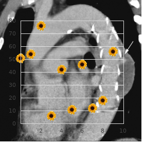 Microcephaly autosomal dominant