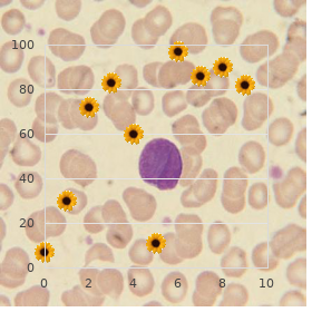 Megaloblastic anemia