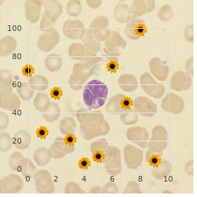 Maroteaux Lamy syndrome