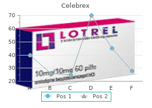 buy line celebrex