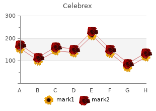 cheap celebrex 200mg line