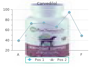 carvedilol 25 mg sale