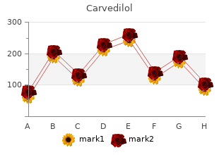 generic carvedilol 6.25mg fast delivery