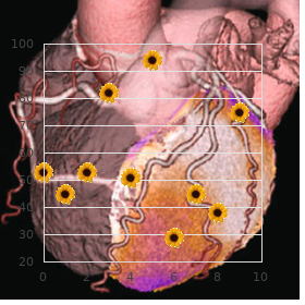 Hemi 3 syndrome