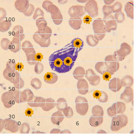 Myoglobinuria