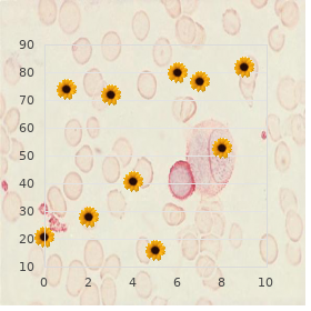 Chromosome 16, trisomy