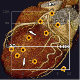 Charcot Marie Tooth type 1 aplasia cutis congenita