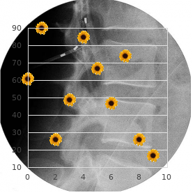 Emery Dreifuss muscular dystrophy, X-linked