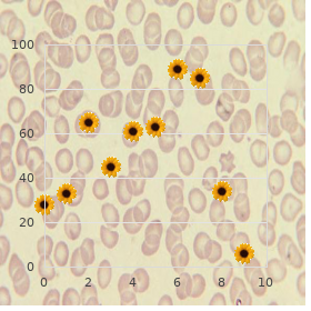 Camptodactyly syndrome Galajara type 1