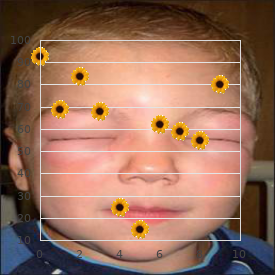 Dermatomyositis