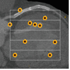 Ectodermal dysplasia osteosclerosis