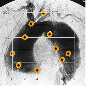 Shy Drager syndrome