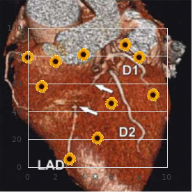 Osteomalacia