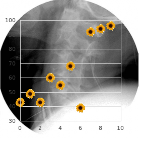 Ballard syndrome