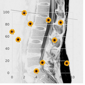 Ceroid lipofuscinosis, neuronal 4